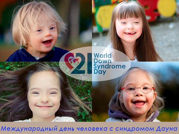 21 марта — Международный день человека с синдромом Дауна